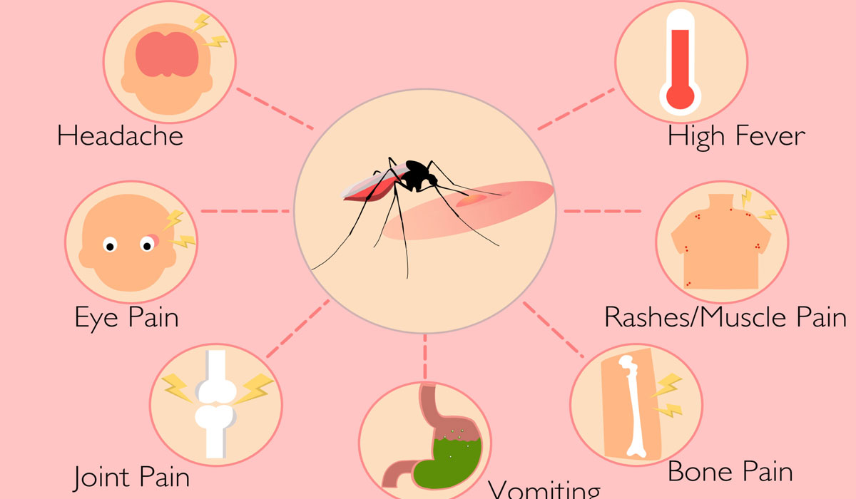 Dengue – It’s Causes, Symptoms, Prevention And Treatment - Medical ...