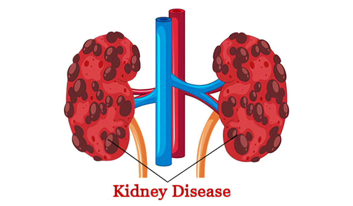 Kidney Disease: The Neglected Fatal Disease - Medical Tourism in India ...