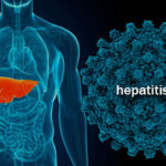 What you need to know about Hepatitis C