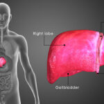 7 Signs your Liver is Unhealthy and Struggling