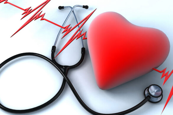 Escorts Heart Checkup