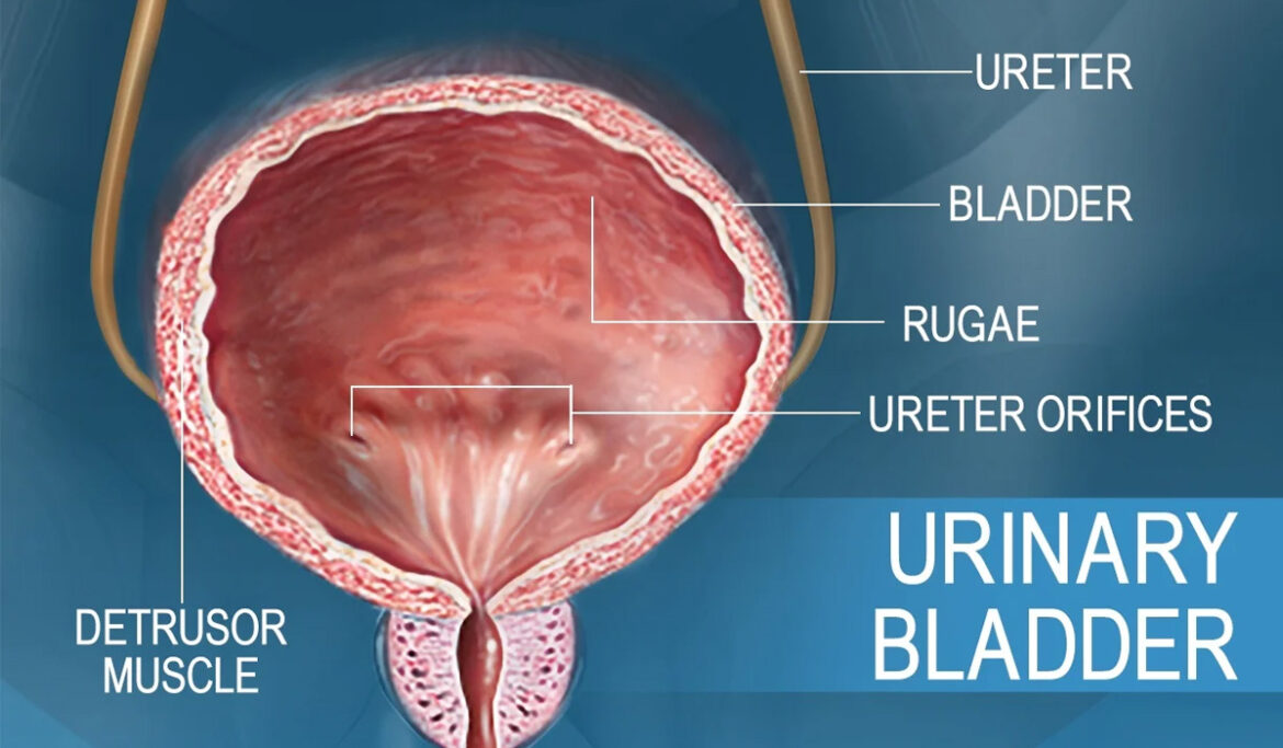 Bladder Cancer Treatment in India | BCG Bladder Cancer Surgery