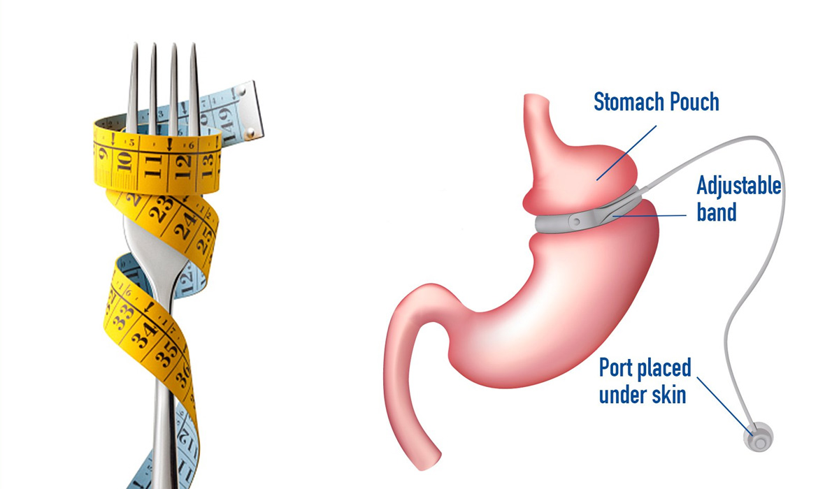 columbia stem cell treatment cost