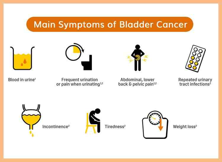 Everything You Need to Know About Bladder Cancer in Men
