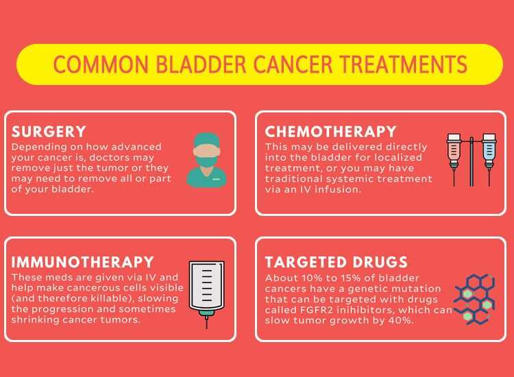 Everything You Need To Know About Bladder Cancer In Men